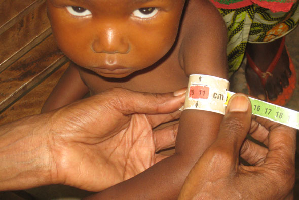Child's arm being measured for malnutrition
